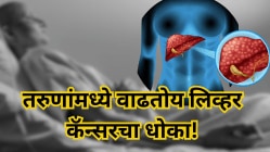 तरुणांमध्ये वाढतोय लिव्हर कॅन्सर! आहारात बदल करून वाचवा स्वतःचे यकृत