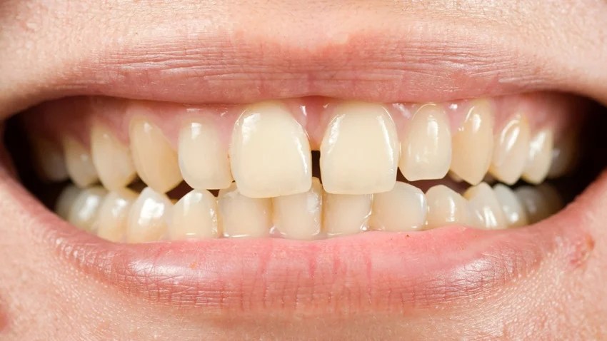 teeth shape personality what your teeth reveal about your luck and life