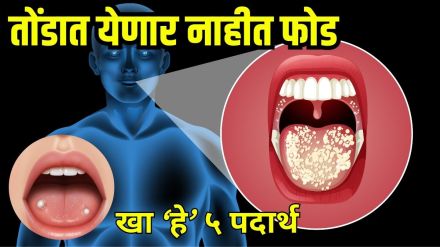 Mouth ulcer causes and remedies