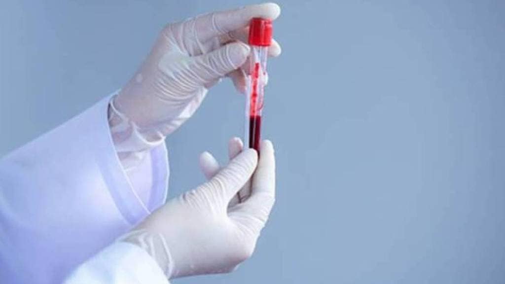 The level of triglycerides in children country alarming