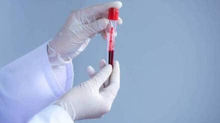 The level of triglycerides in children country alarming