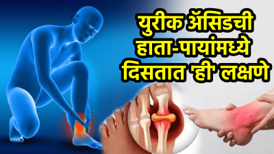 शरीरात युरीक अ‍ॅसिड रुपात विष पसरल्यास हाता-पायांमध्ये दिसतात ही लक्षणे; वेळीच ओळखा…