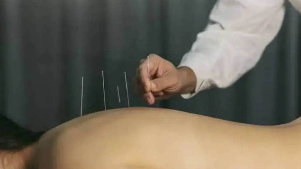 Maharashtra acupuncture courses