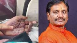 फलटण डॉक्टर आत्महत्या प्रकरणात राजकीय, पोलीस अधिकाऱ्यांचा दबाव ; अंबादास दानवे यांचा माजी खासदार रणजित निंबाळकरांवर आरोप