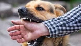 Bite from pet dog in Shivajinagar Khadki