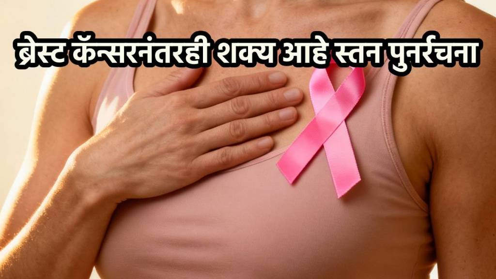 Breast cancer Breast cancer