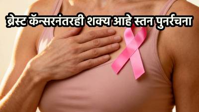 ब्रेस्ट कॅन्सरनंतरही शक्य आहे स्तन पुनर्रचना; आता विमा कंपनी देईल खर्चाची साथ!