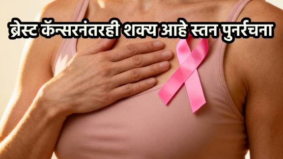 Breast cancer