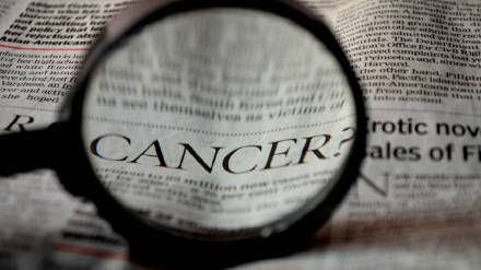 cancer surgery Burkitt Lymphoma on a four-year-old boy A fast-growing cancer of B cells