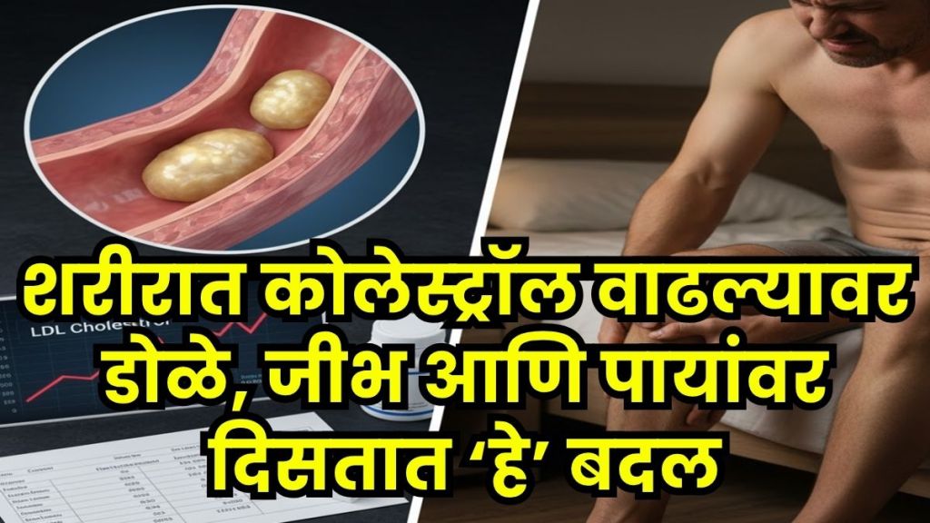 high cholesterol causes and symptoms high cholesterol causes and symptoms