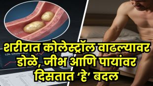 high cholesterol causes and symptoms