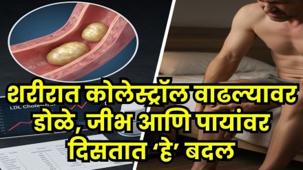 high cholesterol causes and symptoms high cholesterol causes and symptoms