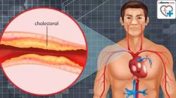 Food To Reduce Bad Cholesterol: तुम्ही एलडीएल कोलेस्ट्रॉलने त्रस्त आहात का? मग ‘या’ गोष्टी ठरतील फायदेशीर, जाणून घ्या!