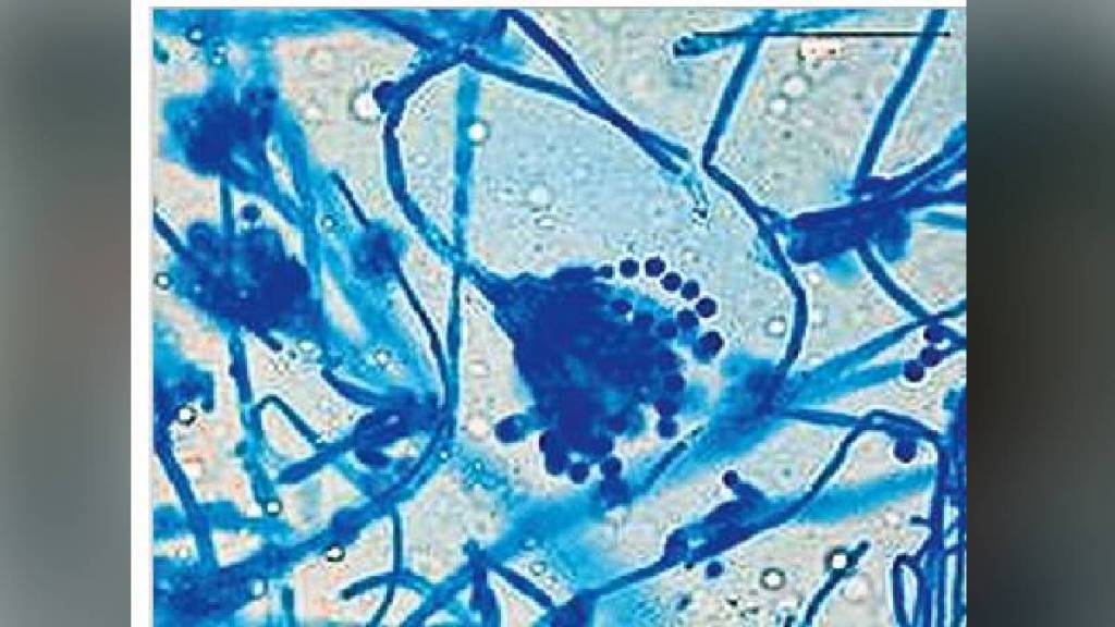 Loksatta kutuhal Fungal depilatory Keratinase