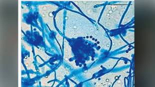 Loksatta kutuhal Fungal depilatory Keratinase