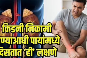Kidney Failure Warning Signs