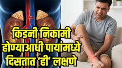किडनी बिघडताना शरीर ओरडून देतं असतं ‘हे’ ७ संकेत; आरशात पाहताना वेळीच ओळखा धोका, दुर्लक्ष केलं तर मोजावी लागेल मोठी किंमत…  