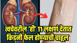 किडनी निकामी होण्याआधी त्वचेवर दिसतात ‘ही’ ११ लक्षणं; आरशात पाहताना वेळीच ओळखा धोका, दुर्लक्ष केल्यास होऊ शकते नुकसान