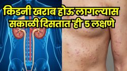किडनी फेल होण्यापूर्वी सकाळी उठताच शरीरात दिसतात ‘ही’ ५ लक्षणे; अजिबात दुर्लक्ष न करता ‘हे’ बदल आणि संकेत वेळीच ओळखा, नाही तर…