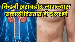 Kidney Failure Signs