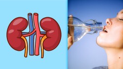 Kidney Health: किडनी स्टोनचा त्रास टाळण्यासाठी कशी घ्याल आरोग्याची काळजी?