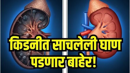 Kidney cleanse drinks
