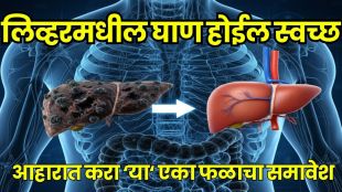 Fatty Liver Home Remedy