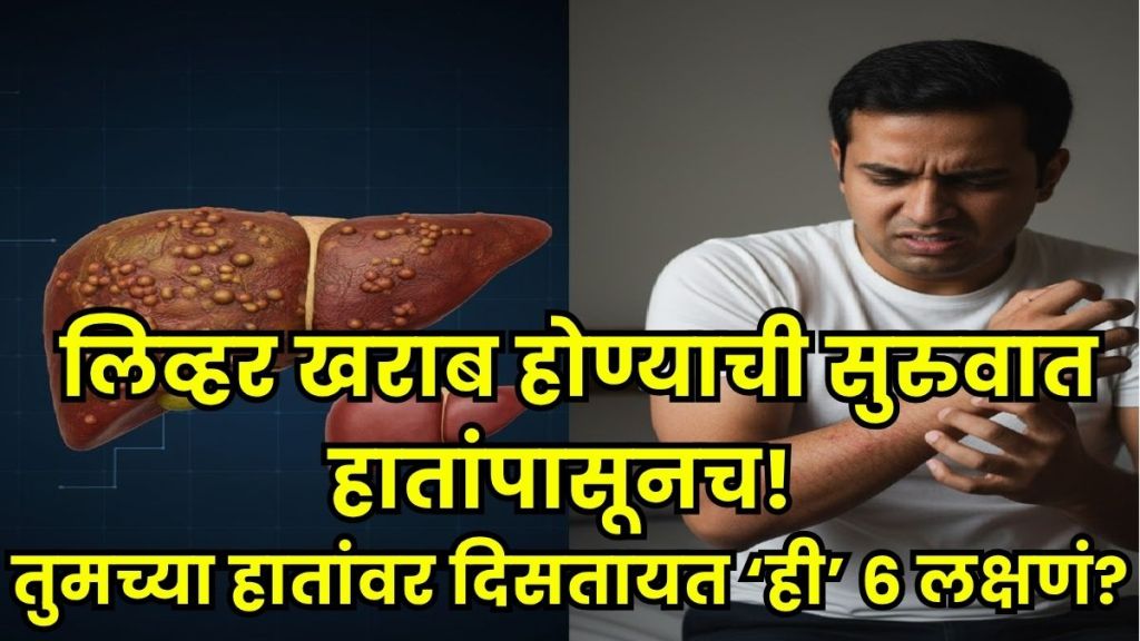 Liver damage signs in hands Liver damage signs in hands