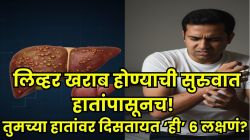 लिव्हर खराब झालं तर हातांवर दिसतात ‘ही’ ६ लक्षणं; जीवघेण्या संकेतांकडे दुर्लक्ष केलं, तर होऊ शकतं मोठं नुकसान!