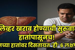 Liver damage signs in hands