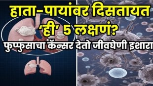 Lung cancer early symptoms