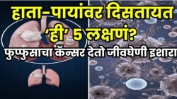 फुप्फुसाच्या कॅन्सरची हाता-पायांवर दिसतात ‘ही’ ५ चिन्हं; साधी लक्षणं अचानक करतात घात, ओढावू शकतो मृत्यू, चुकूनही करू नका दुर्लक्ष