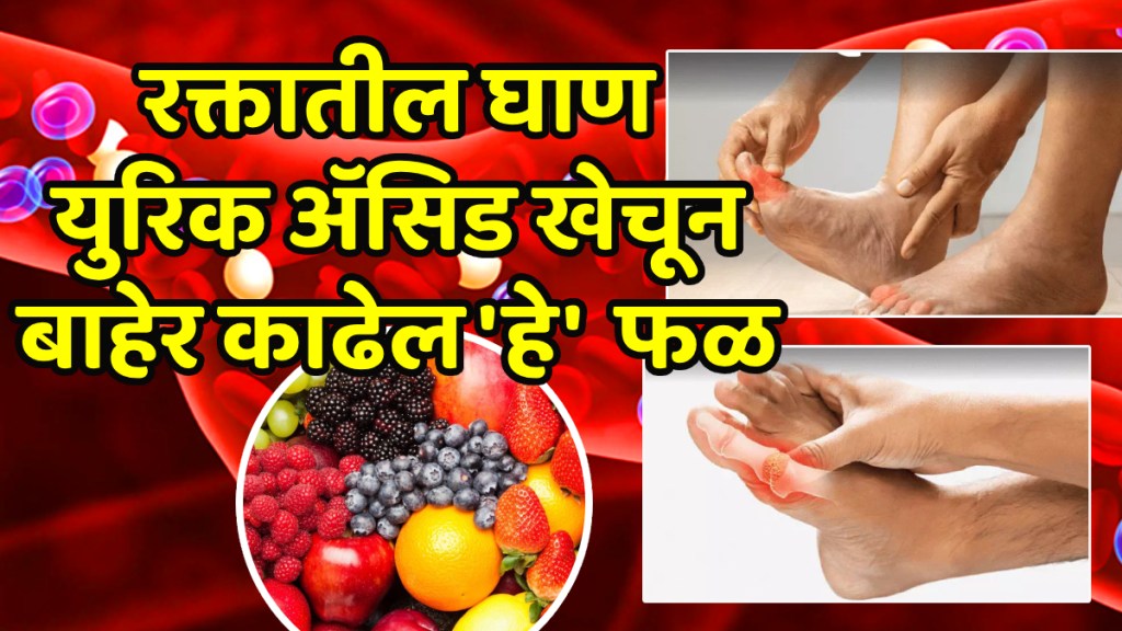 Consume a apply daily for control uric acid naturally joint pain and swelling will improve Consume a apply daily for control uric acid naturally joint pain and swelling will improve