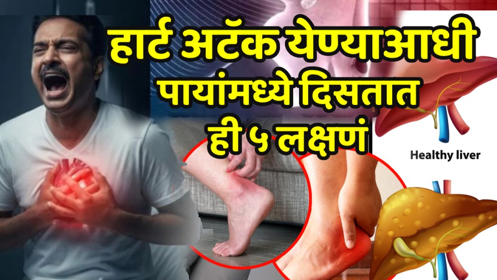 heart decease sign and symptoms in feets swelling cold feet and sores may indicate heart problems