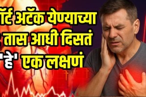 Heart attack early symptoms of heart attack blockage coronary artery disease cardiologist explains first signs