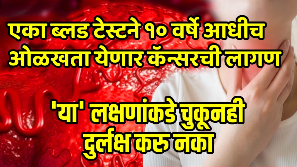 Head and neck cancer: How a simple blood test can detect cancer