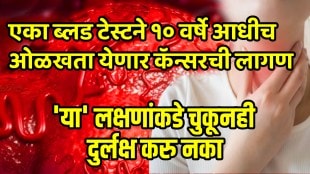 Head and neck cancer: How a simple blood test can detect cancer