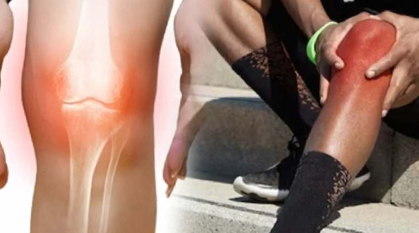 Serious signs of uric acid are also visible on the skin 