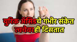 त्वचेवरही दिसून येतात युरिक अ‍ॅसिडचे गंभीर संकेत; वेळीच व्हा सावध, नाहीतर…
