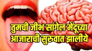 Early symptoms and signs of motor neuron disease tongue will reveal about motor neuron disease learn about study mnd