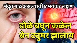 डोळे बघूनच ओळखू शकता तुम्हाला झालाय ब्रेन ट्यूमर; मेंदूत गाठ असल्याची ‘ही’ ४ भयंकर लक्षणं, अजिबात दुर्लक्ष करु नका