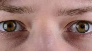 eyes watering