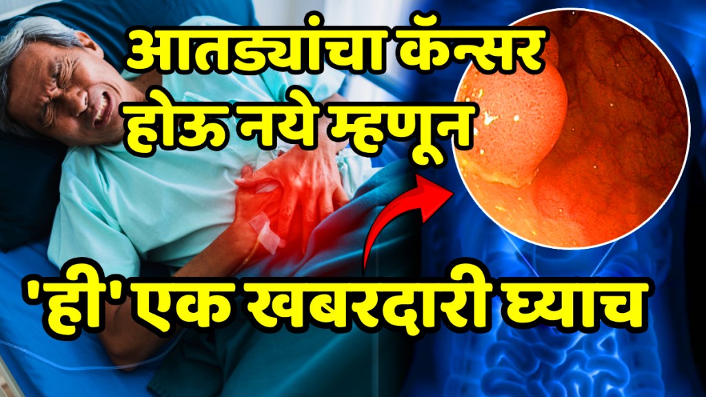 These 5 lifestyle habits that lower risk of colon cancer bowel cancer prevention tips colon cancer risk reduction