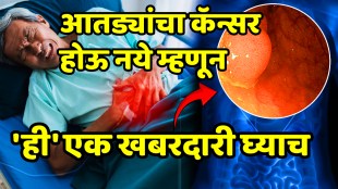 These 5 lifestyle habits that lower risk of colon cancer bowel cancer prevention tips colon cancer risk reduction