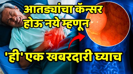 These 5 lifestyle habits that lower risk of colon cancer bowel cancer prevention tips colon cancer risk reduction