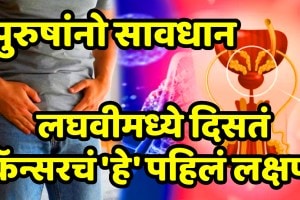 signs of prostate cancer