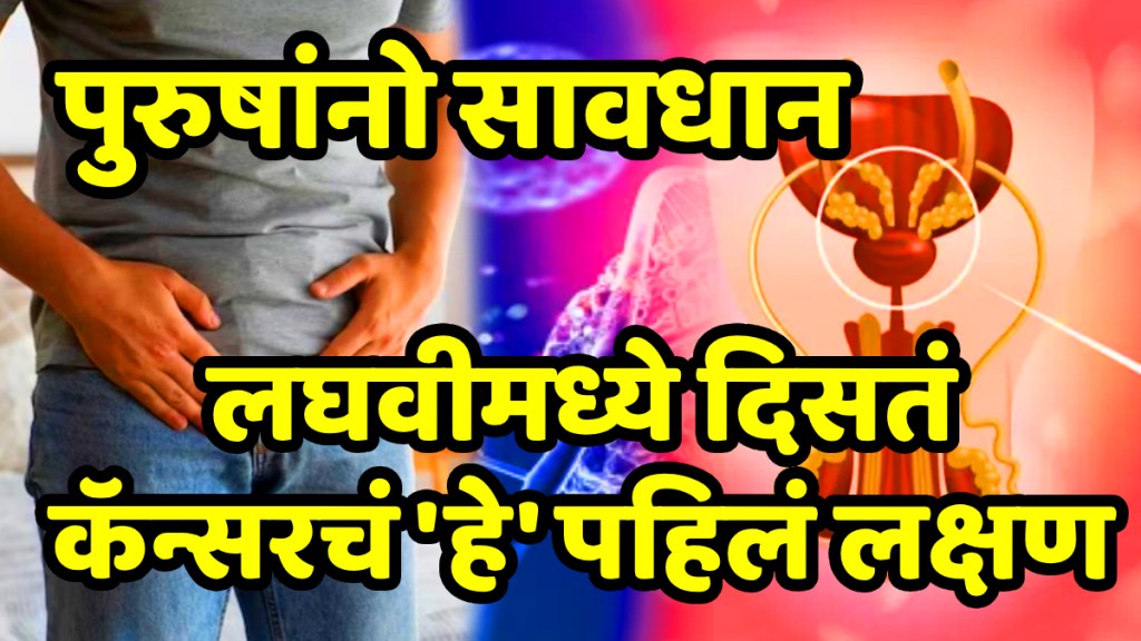 signs of prostate cancer