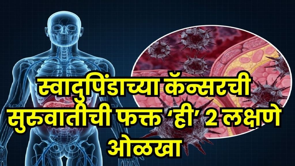 Pancreatic cancer detection