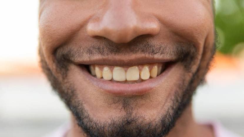 Remedies-For-Yellow-Teeth_d1cd02