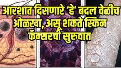आरशात दिसणारी त्वचेवरील ‘ही’ ५ लक्षणं हलक्यात घेऊ नका; स्किन कॅन्सरची असू शकते सुरुवात, दुर्लक्ष केलं तर मोजावी लागेल मोठी किंमत…